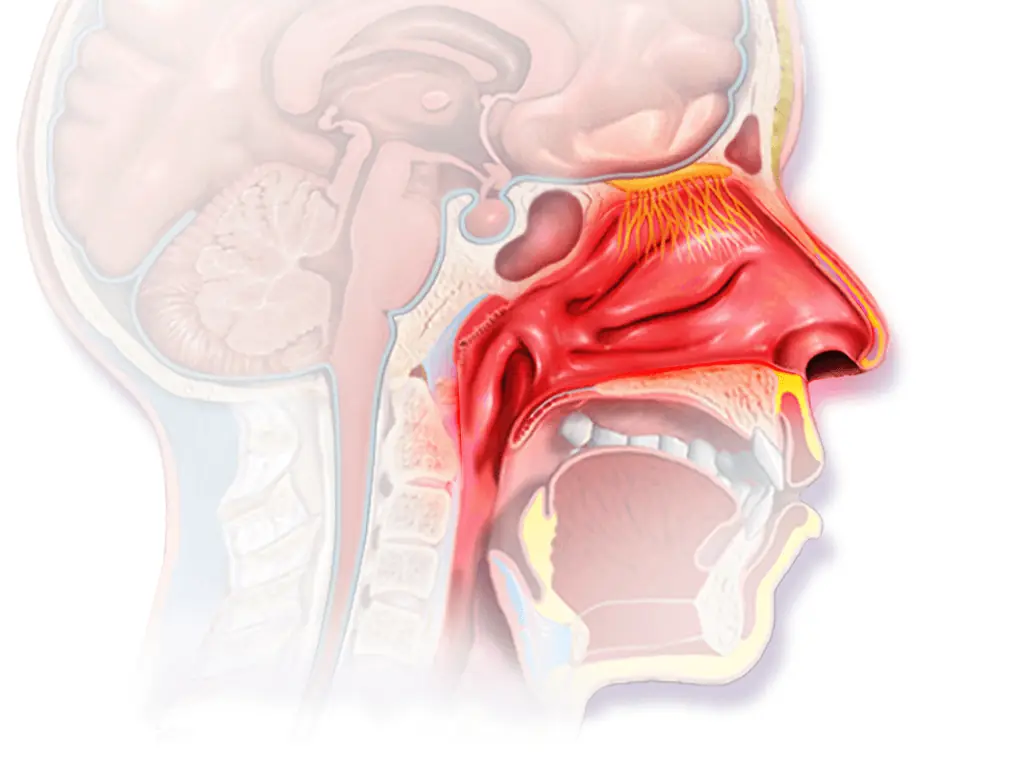 Your Immune System Can Get Better at Being Annoying
